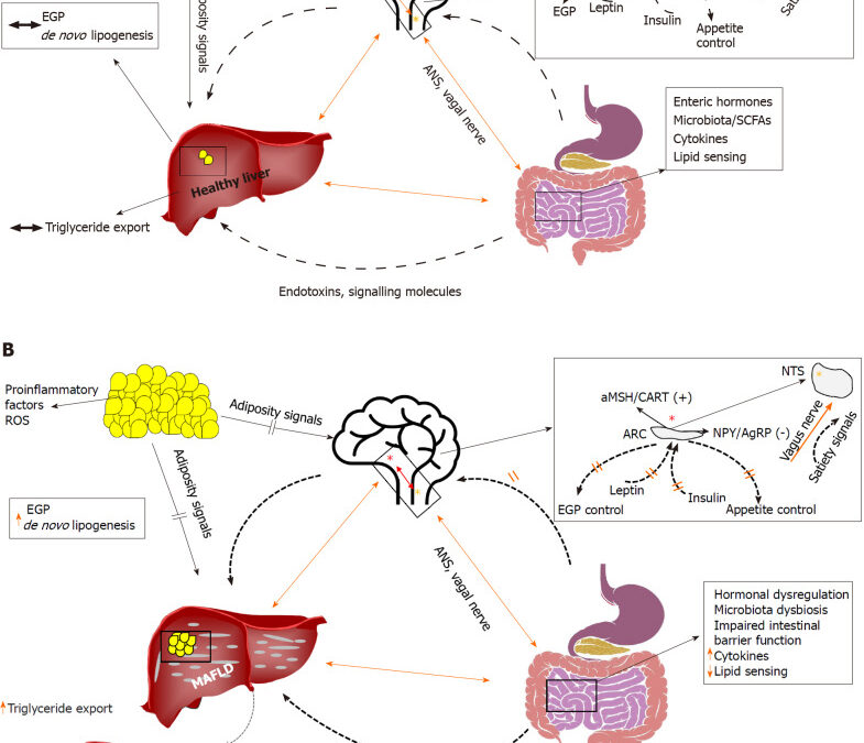 Insulin Resistance and the Brain-Gut-Liver Axis